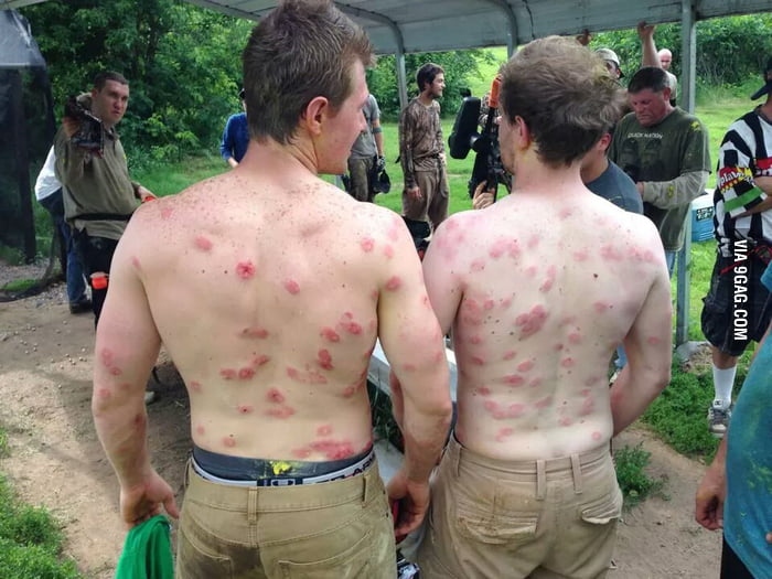 Paintball welts